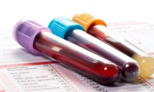 Какие анализы помогут выявить рак на ранней стадии: советы врачей для женщин