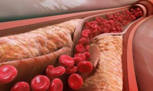 Продукты, снижающие холестерин: что исключить из рациона для здоровья мамы и малыша