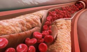 Питание для здоровья сердца: продукты, сохраняющие артерии чистыми